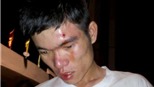 Một CĐV bị hành hung tại sân Gò Đậu sau trận U23 Việt Nam - Sinh viên Hàn Quốc